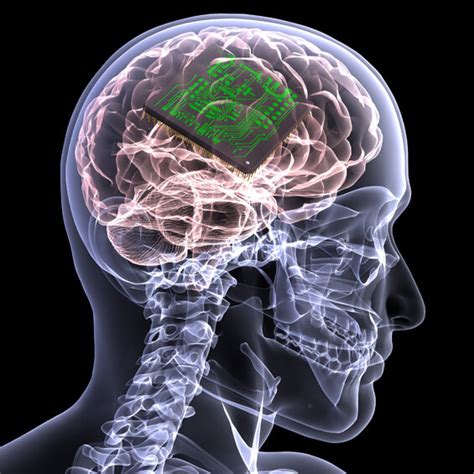 Brain implants might soon restore vision to the blind, improve