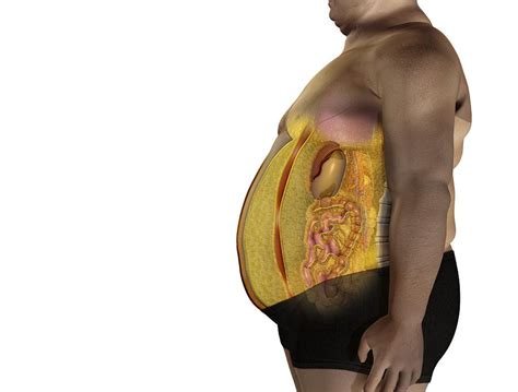 Fat On Inner Organs Artwork Photograph By Claus Lunau