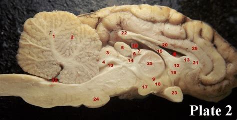 Sheep Brain Sagittal View