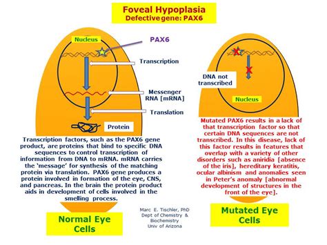 Foveal Hypoplasia 1 Hereditary Ocular Diseases