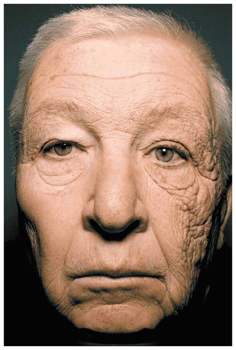 Does Sunscreen Prevent Skin Ageing Sebastian Rushworth Md