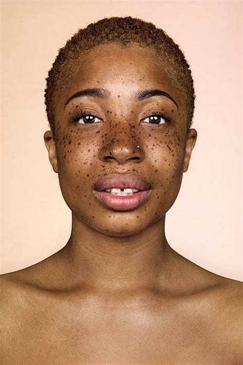 Photos Of People With Freckles Popsugar Beauty Photo 14