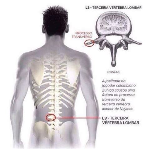 Contribute to m14t/backbone development by creating an account on github. Aspetar سبيتار on Twitter: "#Neymar has been ruled out of the #WorldCup with a broken bone in ...