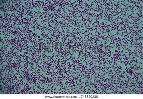 Fish Blood Smear Under Microscope Stock Photo Shutterstock