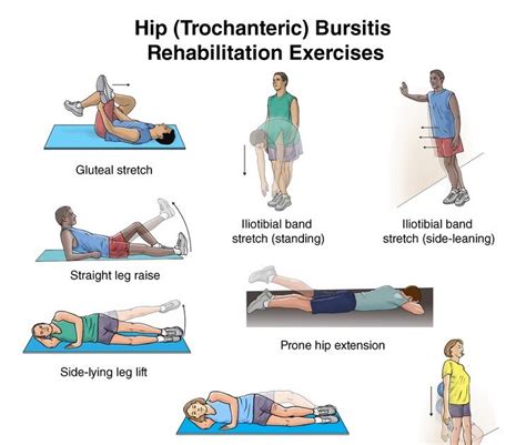 Hip Bursitis Rehab Exercises