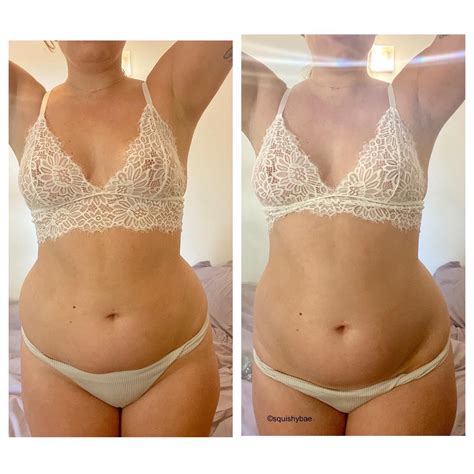 The Before And After Of My First Sprite And Banana Bloat What Do You Think 🍌🍋 R Bellyexpansion