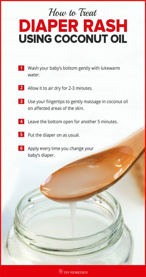 Get Rid Of Diaper Rash Using Coconut Oil