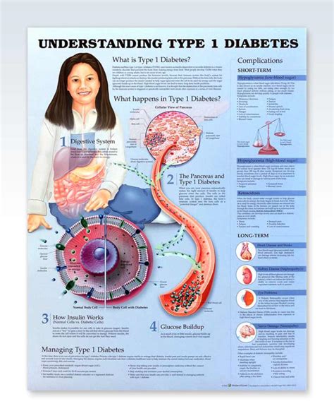 Understanding Type 1 Diabetes Anatomy Poster Clinicalposters