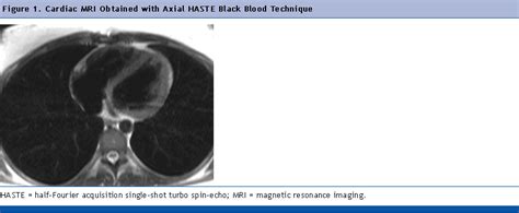 Rad Tech Ce Asrt Arrt® Ce Category A Credits Radiology Continuing