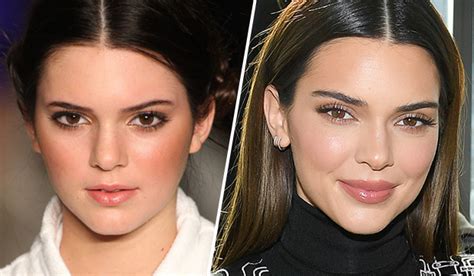 How 10 Celebrities Looked Before And After Getting Suspected Lip
