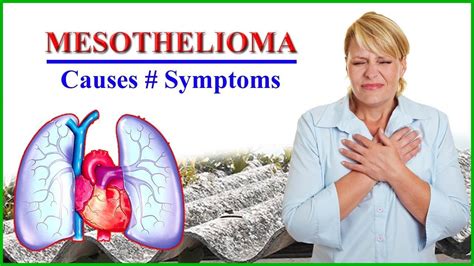 Symptoms or signs of mesothelioma may not appear until 20 to 50 years (or more) after exposure to asbestos. Mesothelioma - Main Causes and Mesothelioma Symptoms for ...