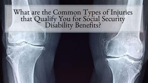 What Are The Common Types Of Injuries That Qualify You For Social Security Disability Benefits