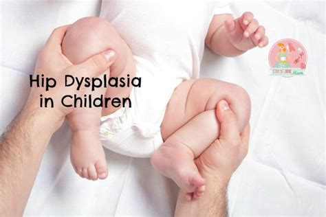 Hip Dysplasia In Children Stay At Home Mum