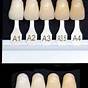 Dentist Tooth Color Chart