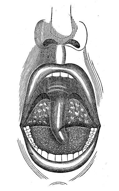 Drawing Of Tonsil Anatomy Illustrations Royalty Free Vector Graphics