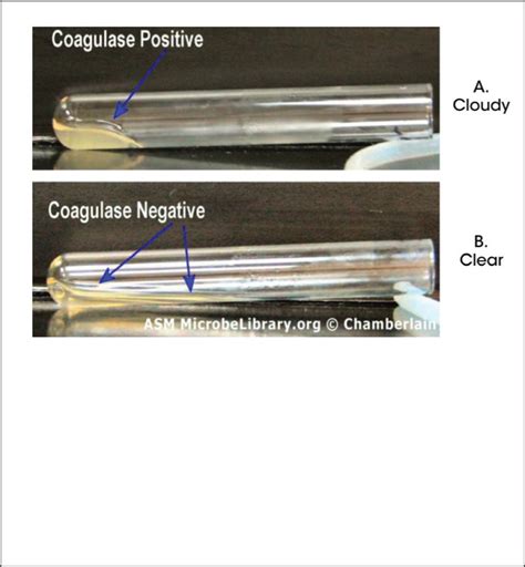Figure 2 Coagulase Test Commonly Used In Faq The Threat Of