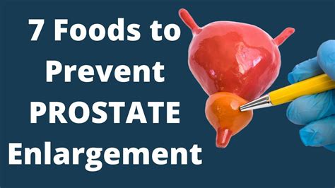Eat These Foods To Prevent Prostate Enlargement VisitJoy YouTube