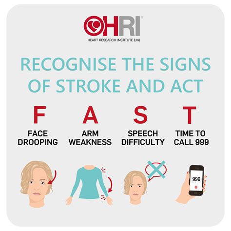Stroke Symptoms Causes Prevention • Heart Research Institute