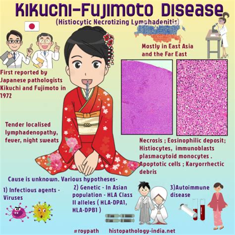 Pathology Of Kikuchi Disease Kikuchi Fujimoto Disease Dr Sampurna