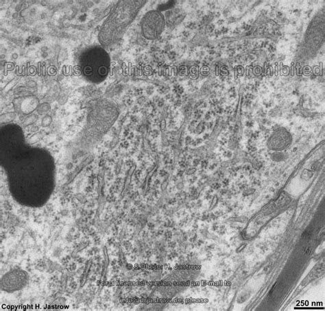 Unlike most plant cells, this species do not have a cell wall. RER - Dr.Jastrows EMAtlas