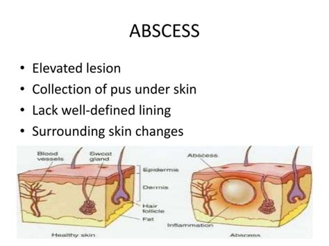 Primary Skin Lesions By Aseem