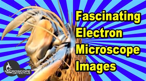 Electron Microscope Images Explore The World In Miniature With A