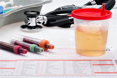 Check spelling or type a new query. What is Hematuria and How It Changes Life Insurance Rates | Urine Test