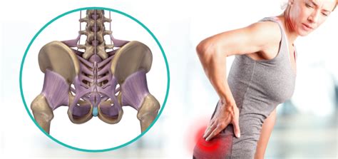 Lower right back pain symptoms. Lower back pain in women - Sequence Wiz