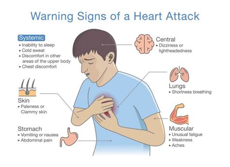 what are men s symptoms of a heart attack warning signs in men