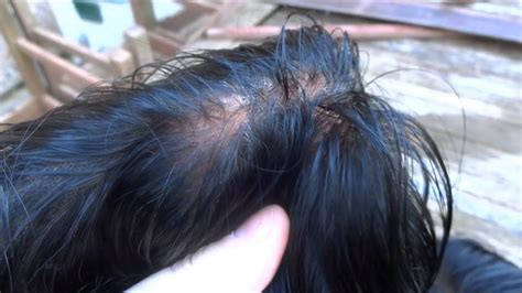 Alibaba.com offers 1,791 black hair bowknot products. Hair Replacement System with black hair and bleached knots ...