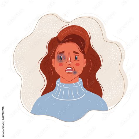 Vector Illustration Of Battered Woman With Injuries Bruises And Abrasions On The Face Victim