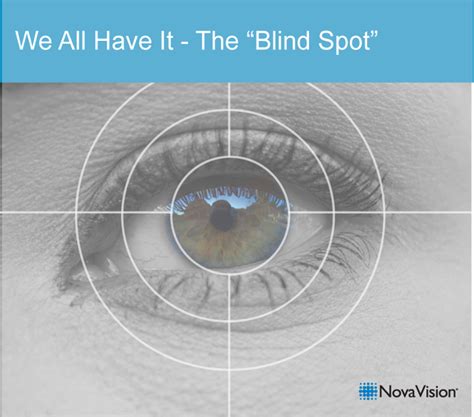 We All Have It The “blind Spot” Novavision