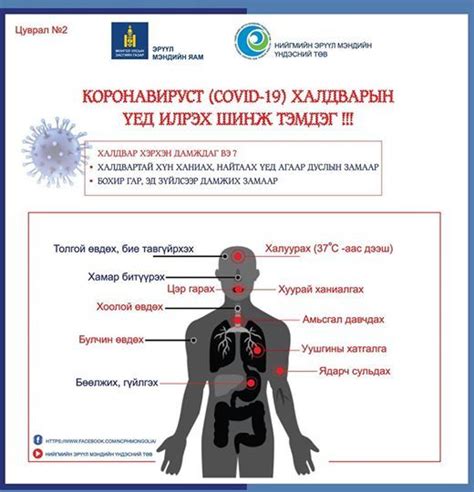НЭМҮТ: Коронавируст (COVID-19) халдварын үед илрэх шинж тэмдэг