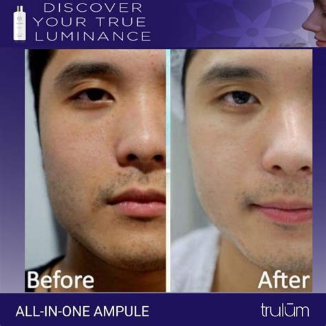 02:17 trulum dari synergy worlwide adalah produk skincare praktis yang trending dan banyak dibicarakan oleh dokter maupun praktisi. Trulum Review - OrderSegera.Com