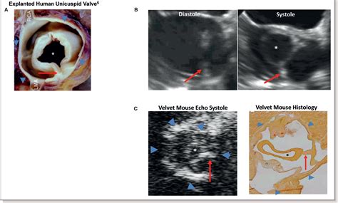 Figure 3 From Discovery Of An Experimental Model Of Unicuspid Aortic