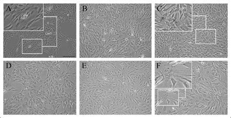 Morphology Of Adipose Derived Mesenchymal Stromalstem Cells During A