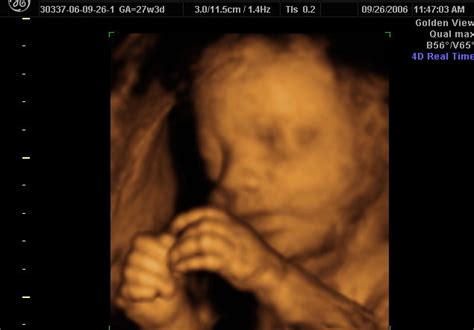 3d maternity imaging is owned and operated by a medical diagnostic ultrasound sonographer with over 10 years experiance. 3d Scanner Image: 3d Sonogram