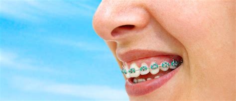 Dr Nazeer Orthodontist Blog Orthodontix Dental Clinic Best Dental