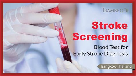 Stroke Screening Identify Stroke Risk And Take Action Trambellir