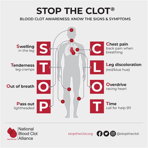 Blood Clot Info Risks Symptoms And Prevention