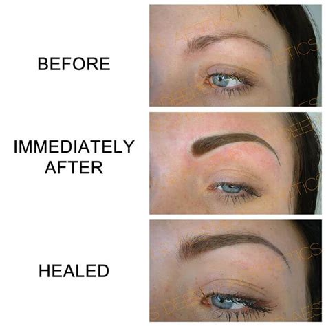 Microblading Aftercare For Your Care