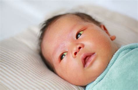 Mengenal Penyakit Kuning Pada Bayi Baru Lahir Penyebab Dan Ciri