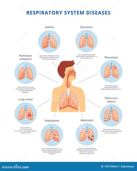 Diagrama Informativo De Ilustraciones Vectoriales De Enfermedades Del Sistema Respiratorio