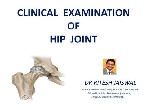 Clinical Examination Of Hip Joint Ppt