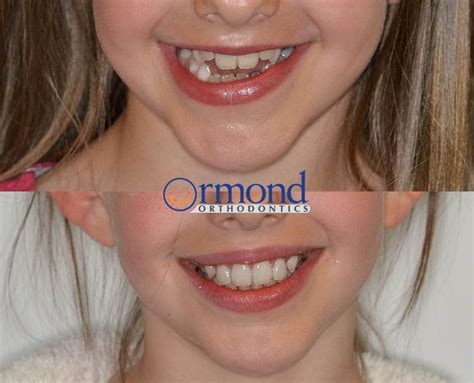 Smiles Ormond Orthodontics