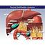Normal Gallbladder Anatomy  TrialExhibits Inc