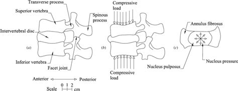 A Schematic Of Spinal Motion Segment Consisting Of Superior And