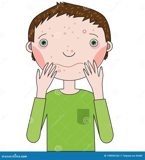 A Guy With A Face On Which Pimples Stock Vector Illustration Of