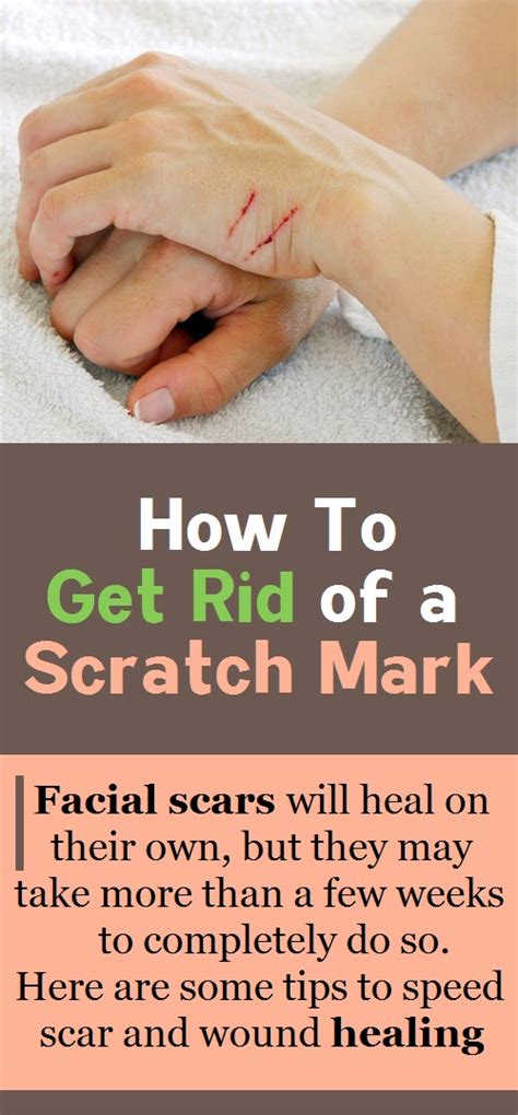 Maybe you would like to learn more about one of these? How To Get Rid of a Scratch Mark? - Charlotte Moore