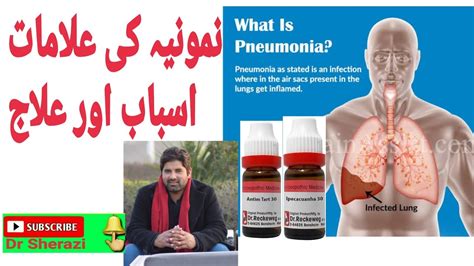 Pneumonia Sign Symptoms Homeopathic Medicine For Pneumonia And